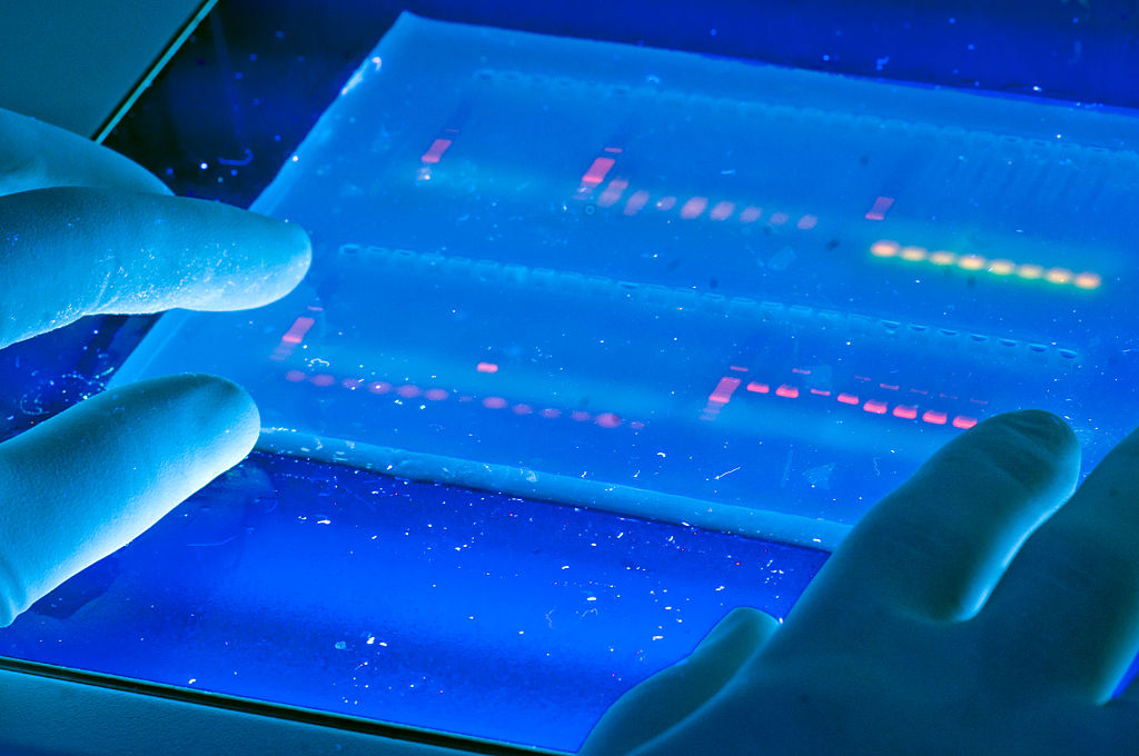 Main Difference - Agar vs Agarose