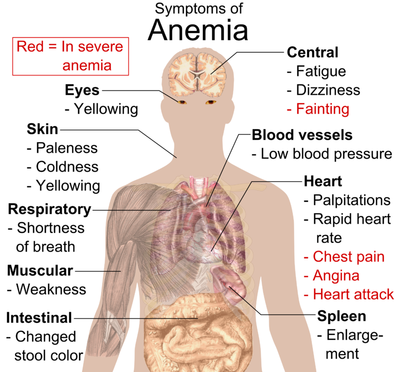 difference-between-anemia-and-iron-deficiency-clinical-features