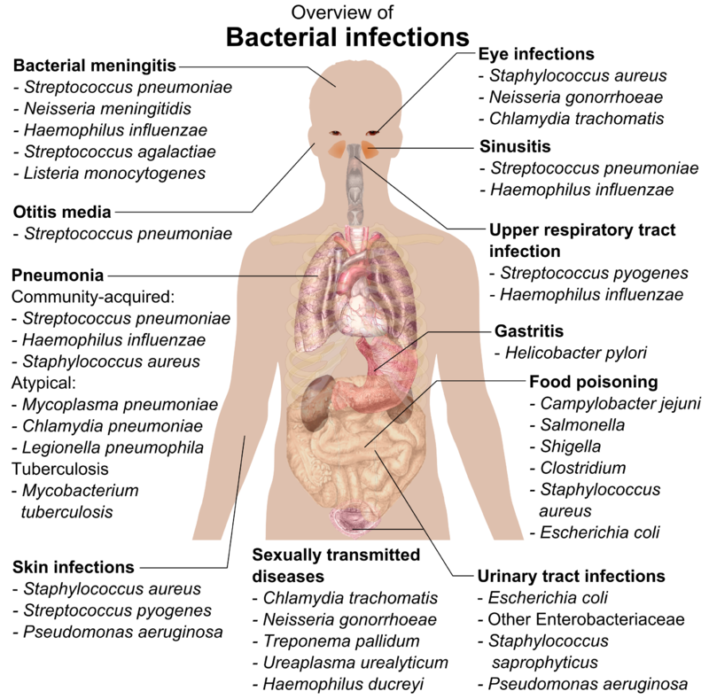 Difference Between Fungal And Bacterial Infection Cause Common Types Treatment