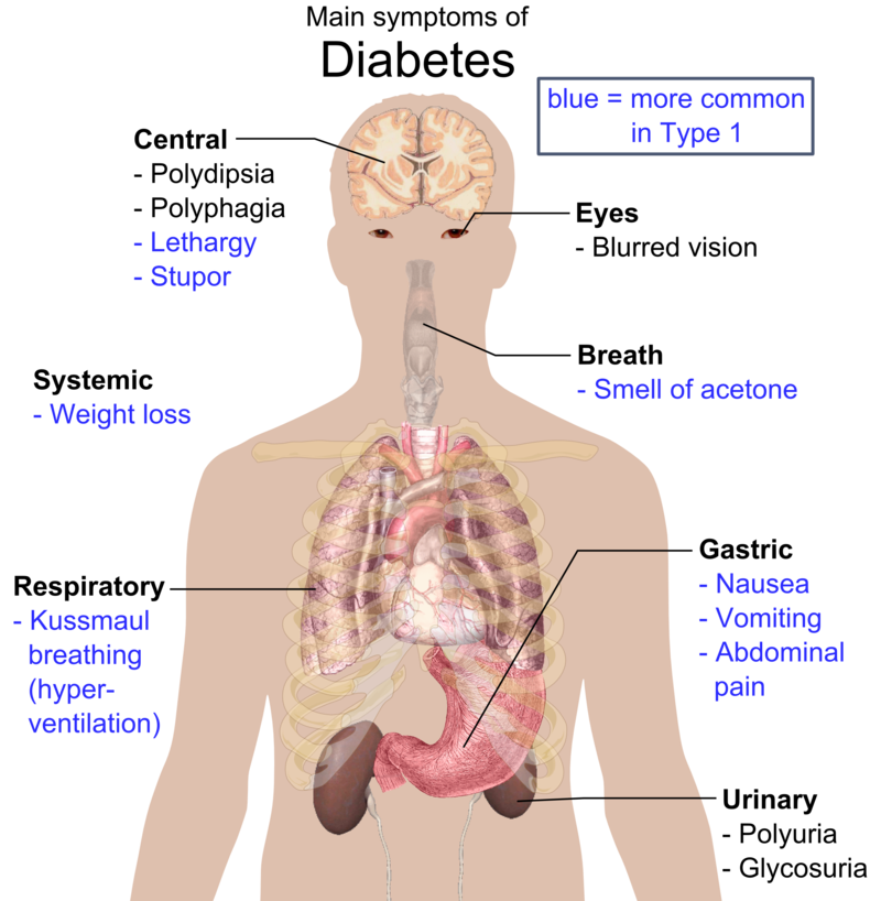 Difference Between Diabetes and Hypoglycemia | Causes, Signs and