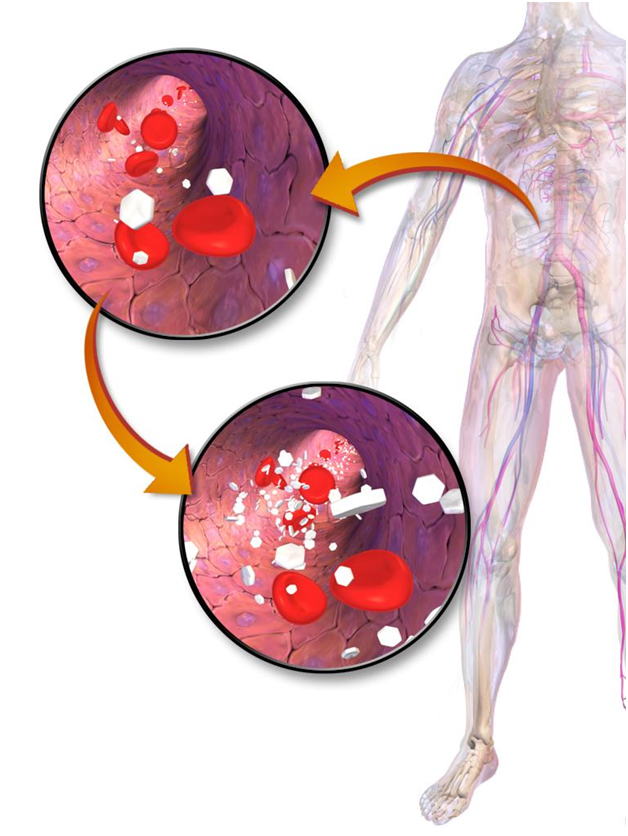 Difference Between Hyperglycemia And Hypoglycemia Causes Signs And 