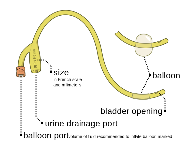 Difference Between Stent and Catheter – Pediaa.Com