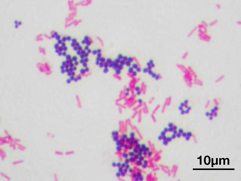 Difference Between Gram Positive and Gram Negative