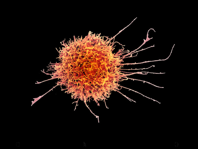 Difference Between Leukocytes and Lymphocytes - 3