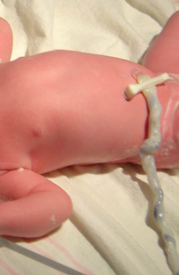 Main Difference - Placenta vs Umbilical Cord