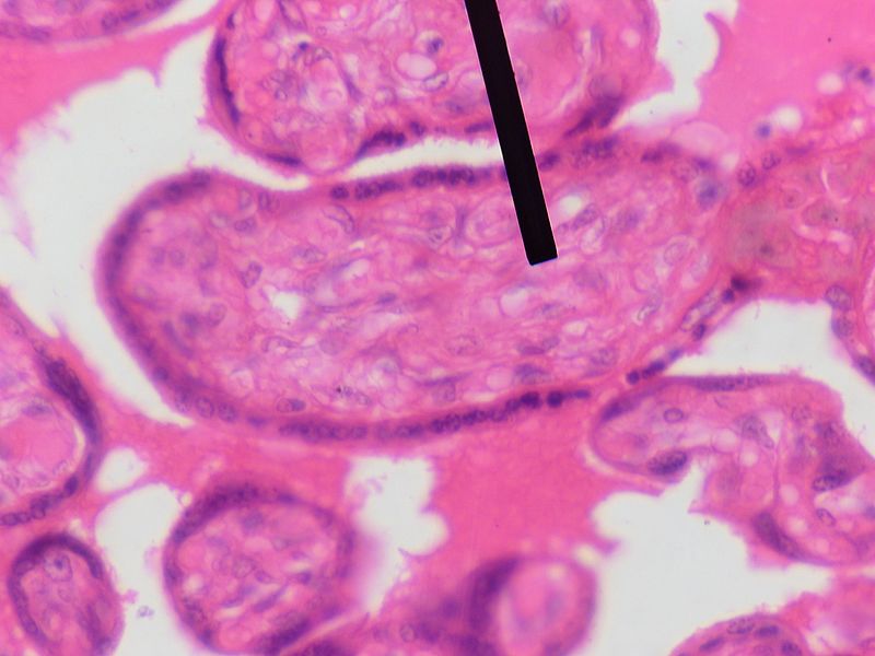 Main Difference - Mesenchyme vs Mesoderm
