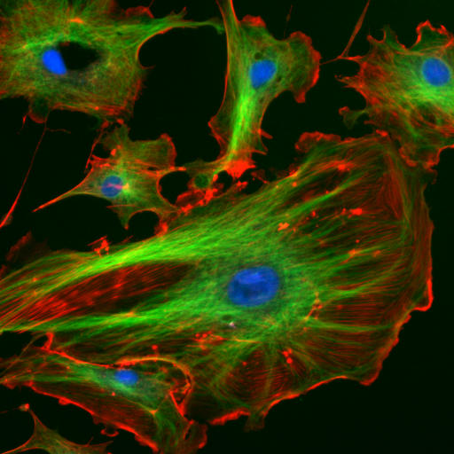 Main Difference - Cell Cortex vs Cytoskeleton