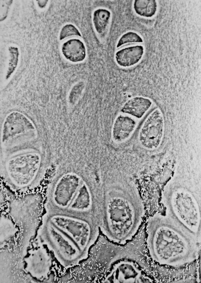 Main Difference - Chondroblasts vs Chondrocytes
