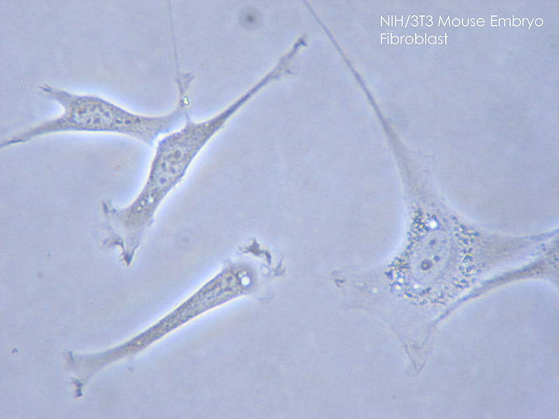 Main Difference - Fibroblast vs Fibrocyte