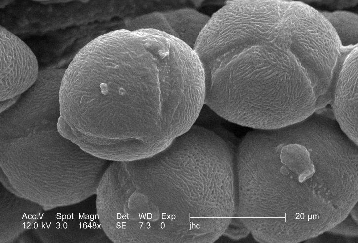 difference-between-male-and-female-gametes-compare-the-difference