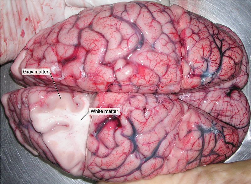 Main Difference - White Matter vs Grey Matter