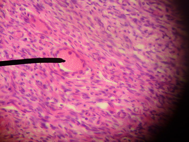 Main Difference - Primordial Follicle vs Primary Follicle