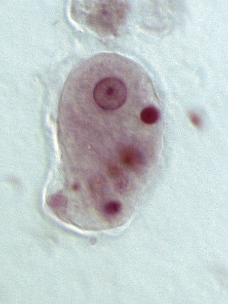 Hauptunterschied - Zyste vs Trophozoit