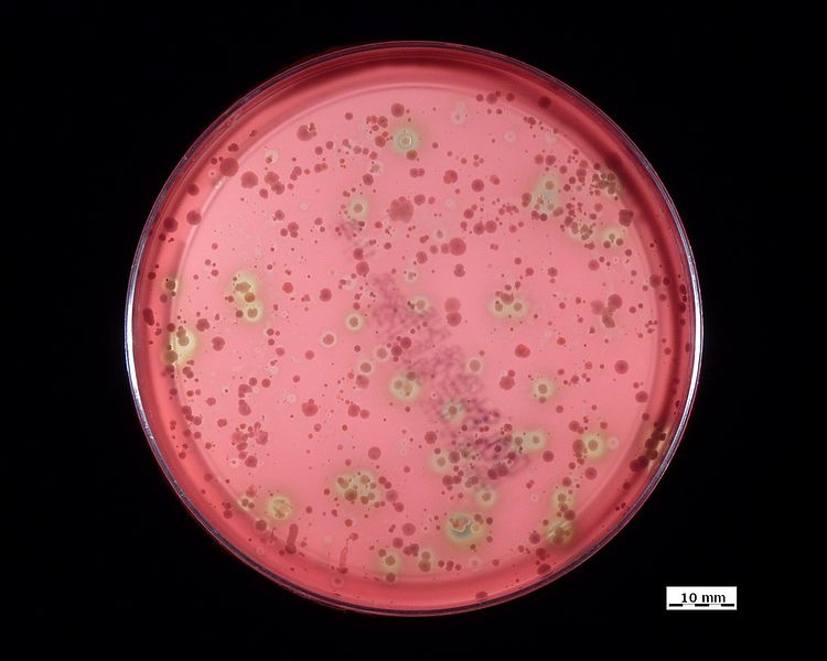 Main Difference - Alpha vs Beta Hemolysis