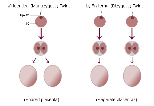 Difference Between Identical and Fraternal Twins - Figure 3