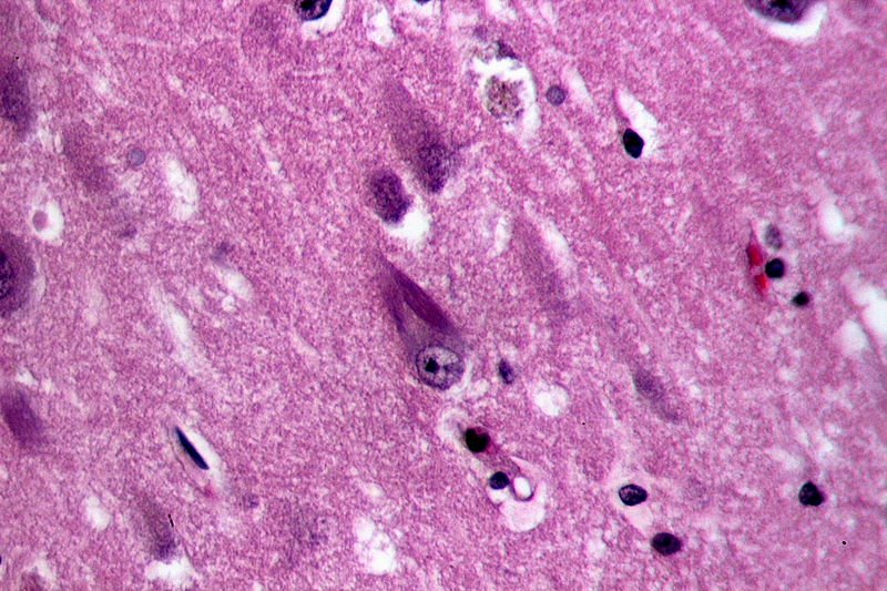 difference-between-pathology-and-pathophysiology-pediaa-com