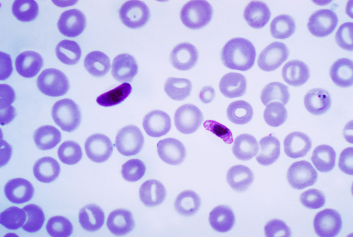 Main Difference - Plasmodium Falciparum vs Plasmodium Vivax