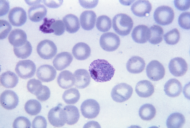 Difference Between Plasmodium Falciparum and Plasmodium Vivax_Figure 4