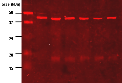 How Does Western Blotting Work_Figure 1