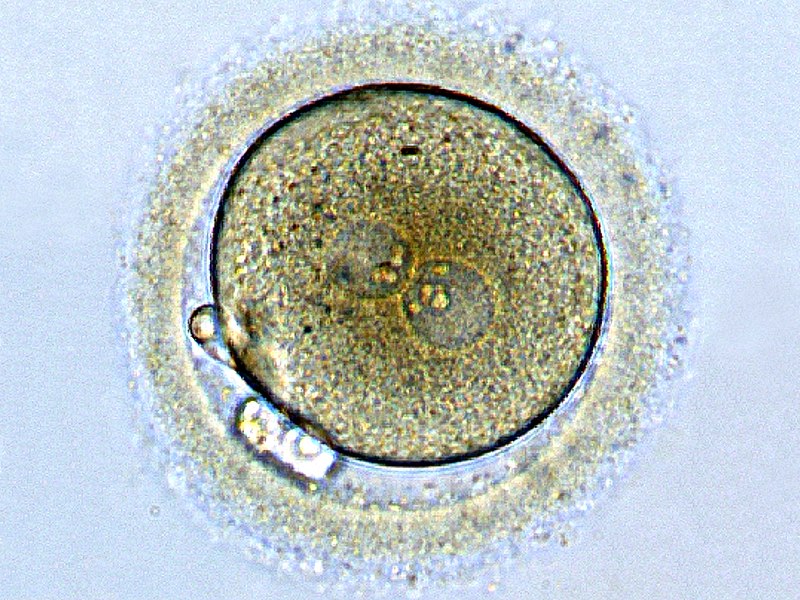 Main Difference - Zoospore and Zygote