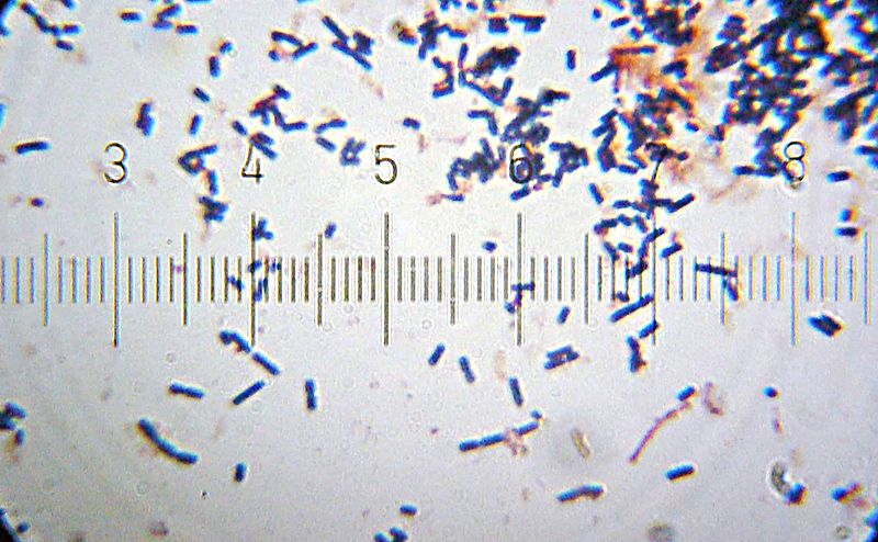 Difference Between Acidophilus and Probiotic