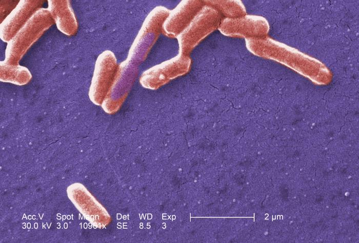 Difference Between Pathogenic And Nonpathogenic Bacteria Pediaacom 