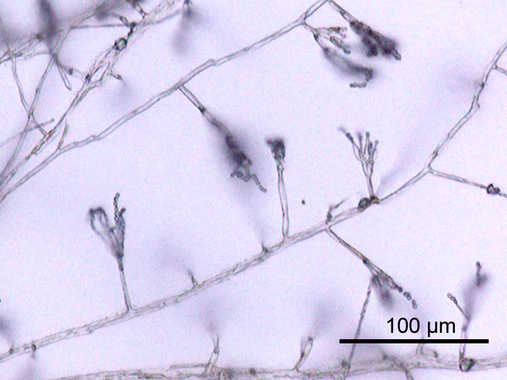 Difference Between Hyphae and Pseudohyphae
