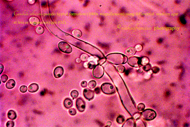 Main Difference - Hyphae and Pseudohyphae