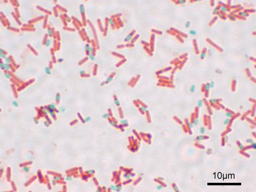 Difference Between Spore Forming Bacteria And Non Spore Forming