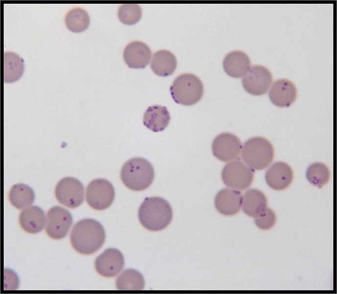 Difference Between Virus and Mycoplasma