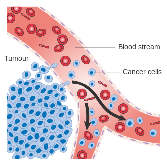 What is the Difference Between Cancer Cells and Normal Cells
