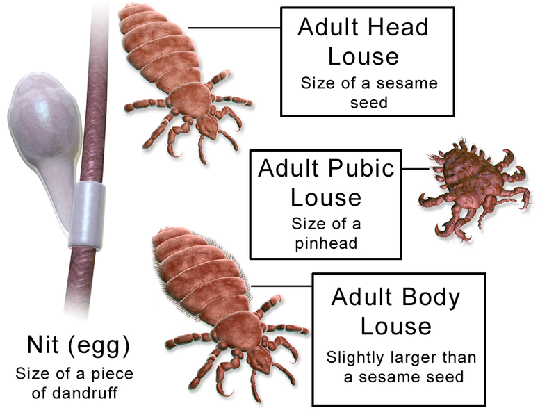 Difference Between Lice And Fleas Pediaa Com