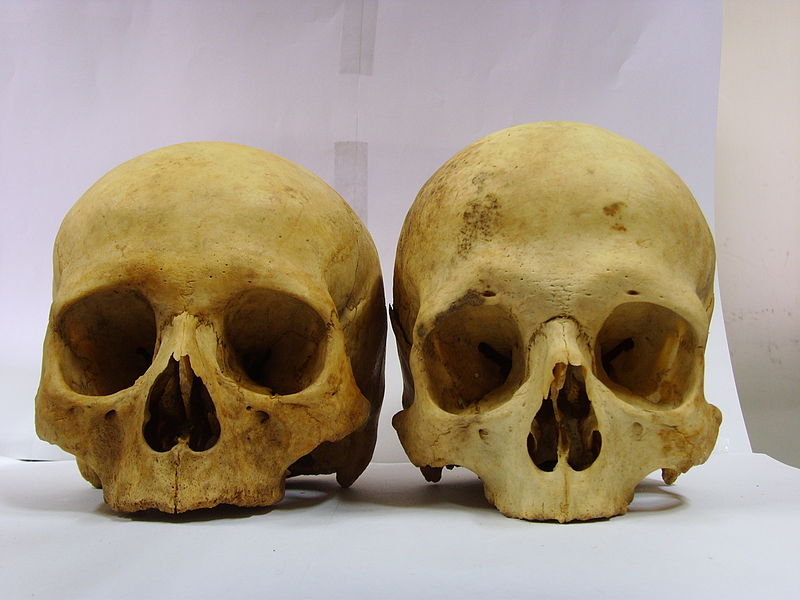 Difference Between Male and Female Skeleton - Pediaa.Com