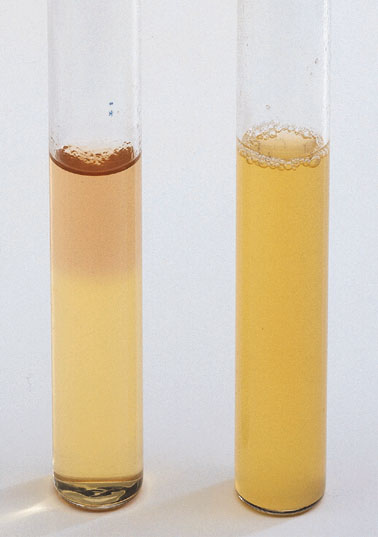 What is the Difference Between Media and Medium in Microbiology_FIgure 1