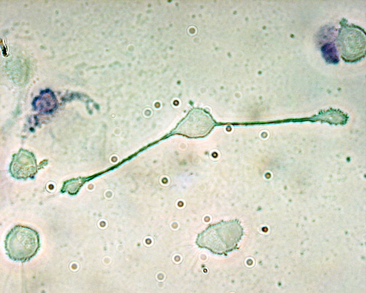 What is the Difference Between Macrophages and Dendritic Cells_Fig 01