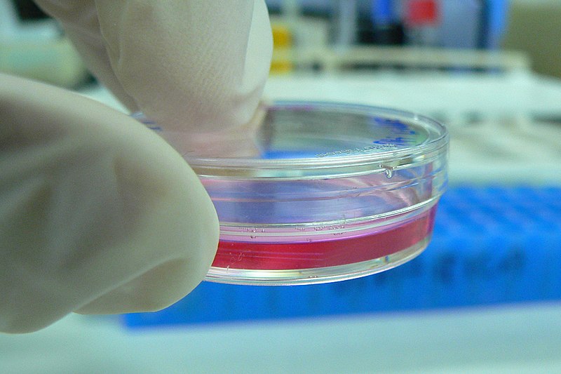 Difference Between Biochemical and Cell Based Assays