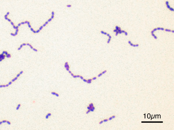 Difference Between Typical and Atypical Bacteria