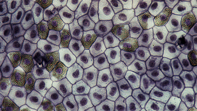 Difference Between Simple Squamous Epithelium And Stratified Squamous Epithelium Pediaa Com