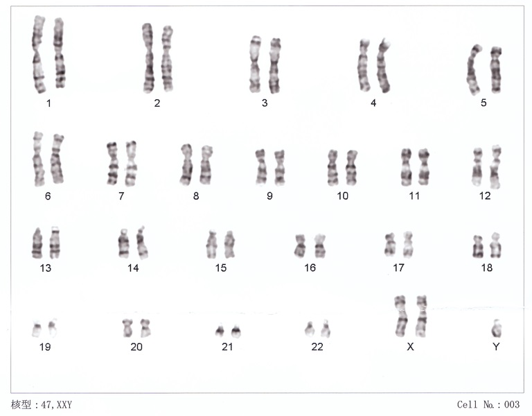 Difference Between Male and Female Karyotypes