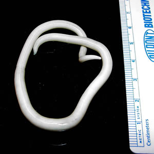 What is the Difference Between Ascaris and Earthworm