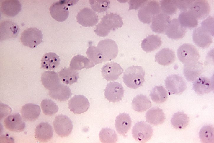 Difference Between Microbiology and Parasitology