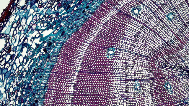 Difference Between Primary Xylem and Secondary Xylem