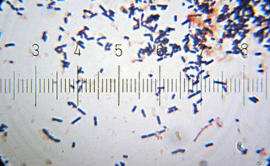 Main Difference - Prebiotics vs Probiotics