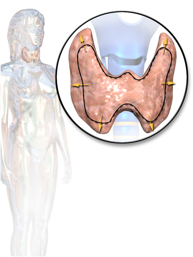 Difference between hypothyroidism and hyperthyroidism causes signs