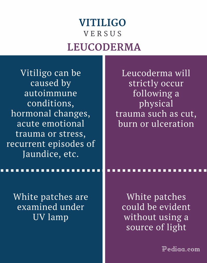 Difference Between Vitiligo and Leucoderma Clinical Features, Causes