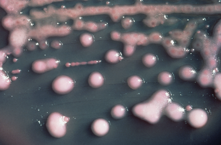 difference-between-e-coli-and-klebsiella-pneumoniae-clinical