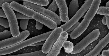 Difference Between E Coli and Klebsiella Pneumoniae