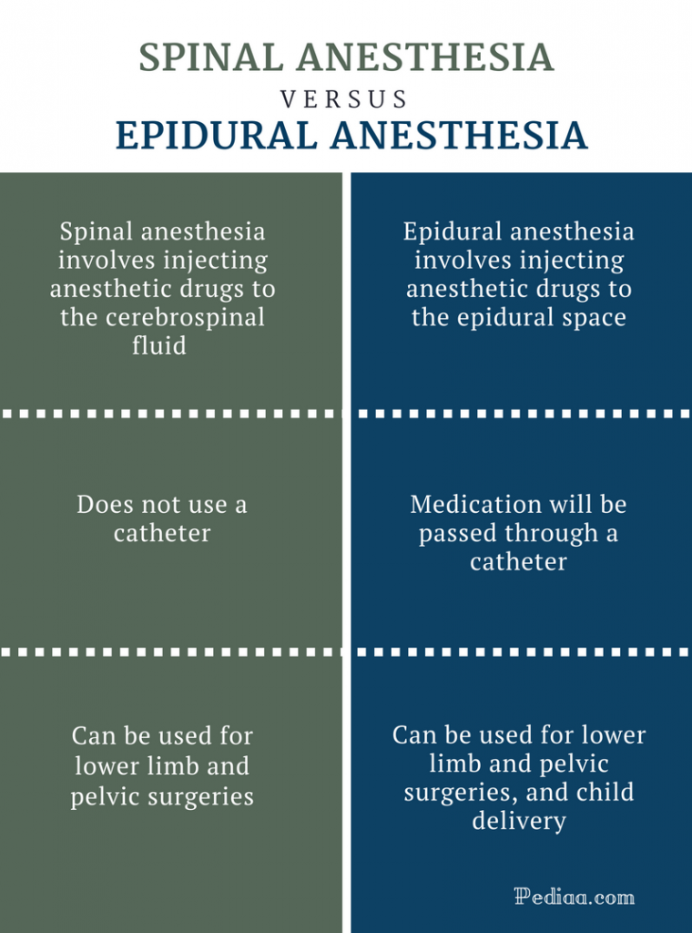 Difference Between Epidural And Spinal Anesthesia Difference – NBKomputer