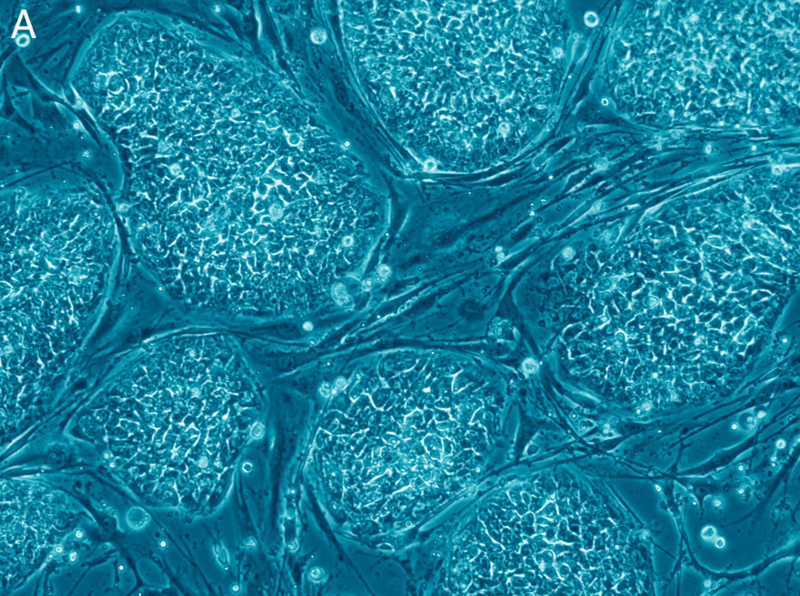 Main Difference - Adult vs Embryonic Stem Cells 