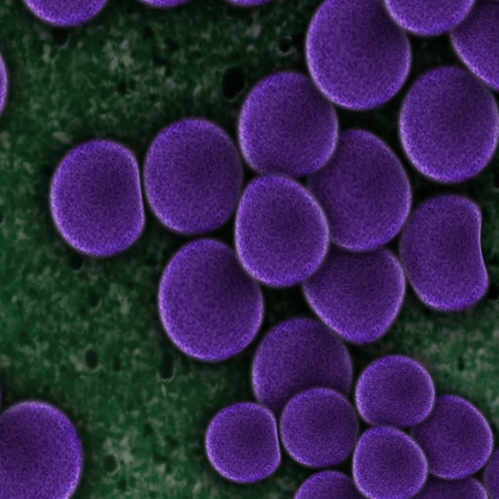 Difference Between Bacteria and Virus